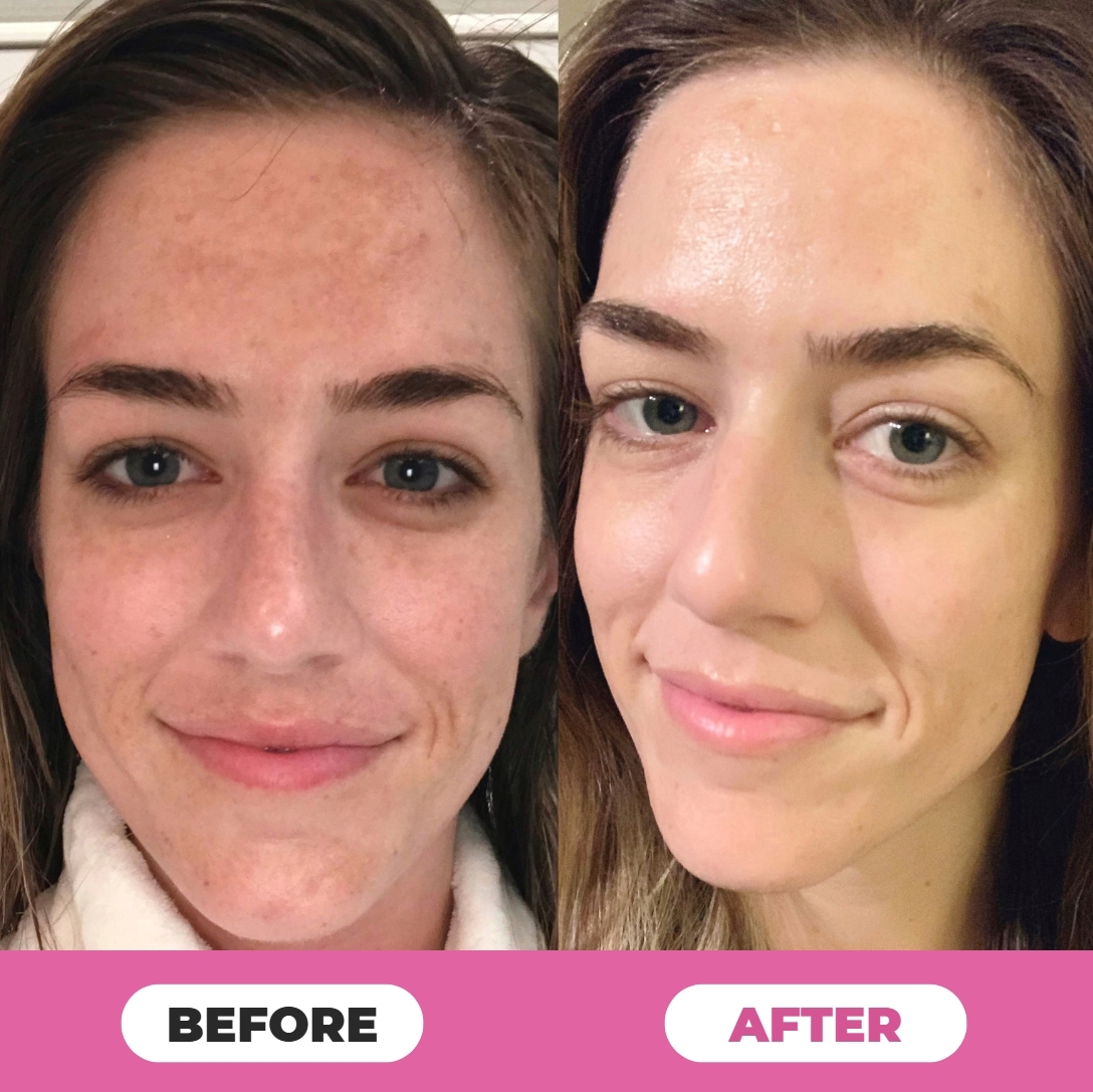 Evermark™ Anti Aging Calibalm