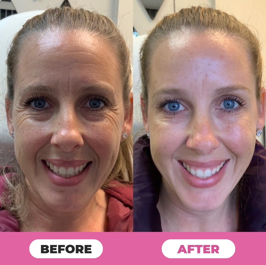 Evermark™ Anti Aging Calibalm